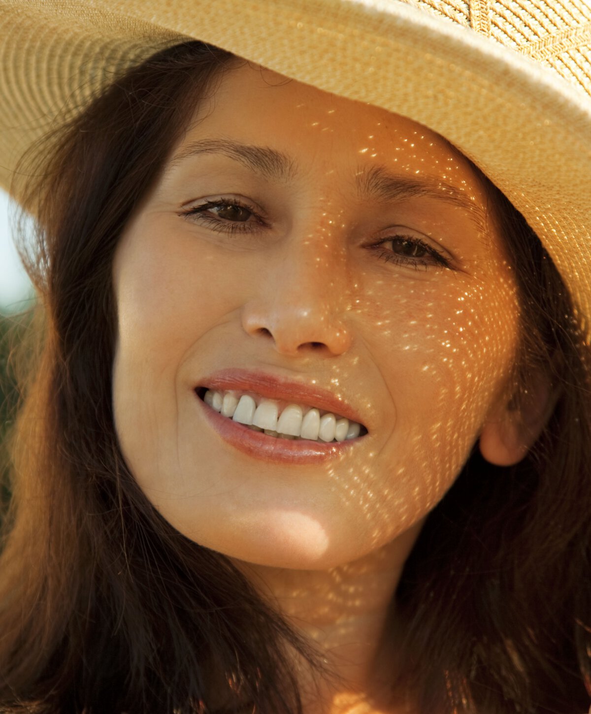 New Orleans Upper Blepharoplasty model in sun hat