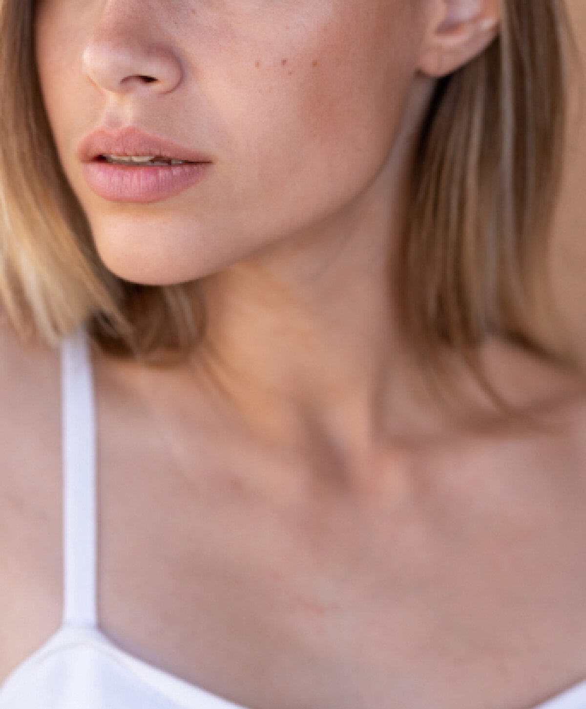 New Orleans revision rhinoplasty patient