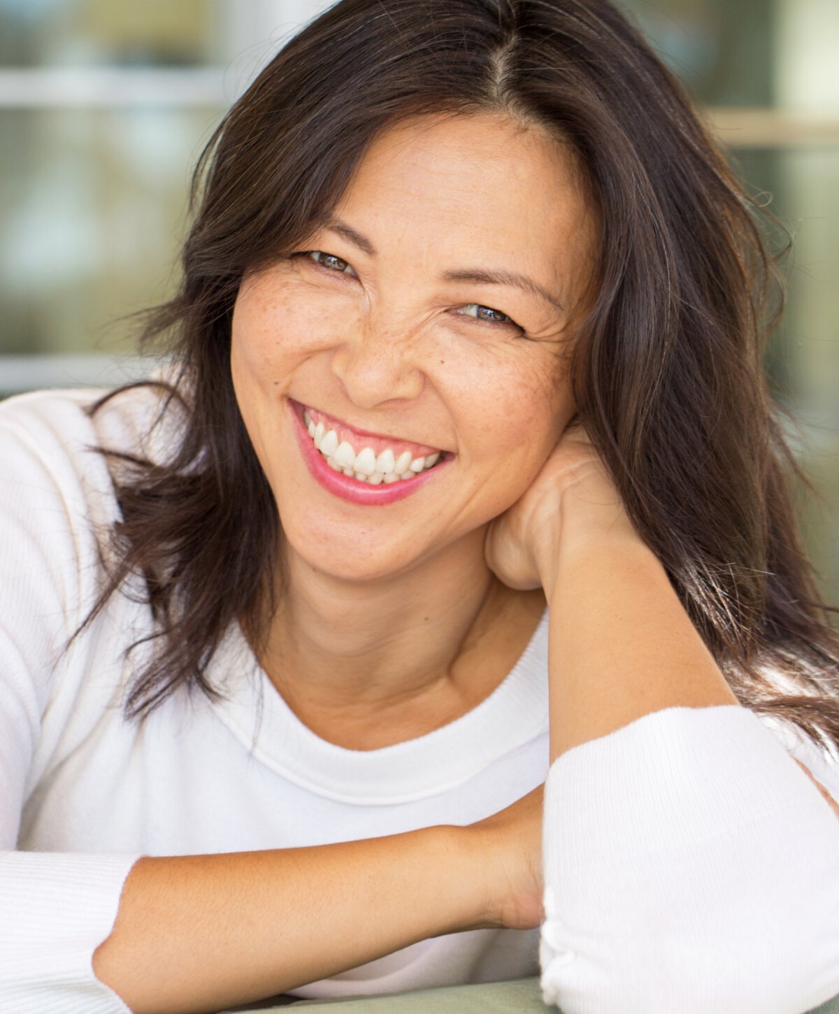 New Orleans CO2 laser resurfacing model woman