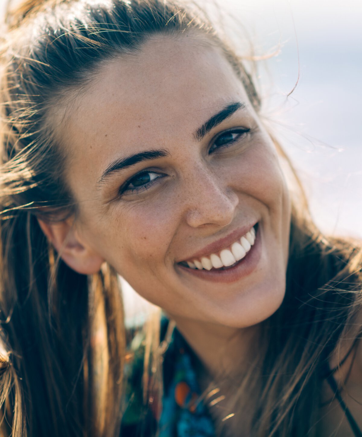 New Orleans Hairline lowering model smiling